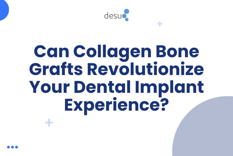 Can Collagen Bone Grafts Revolutionize Your Dental Implant Experience