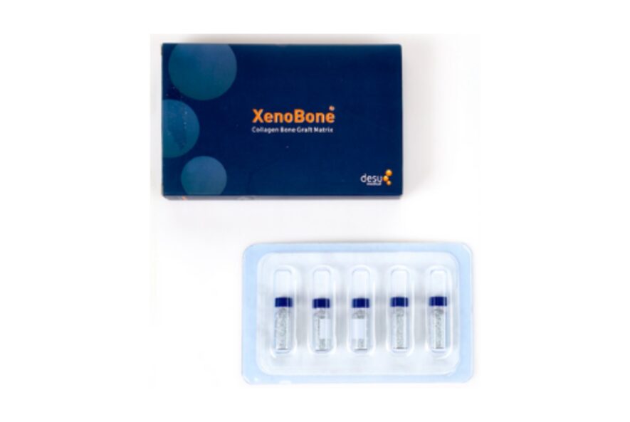 Bone Grafts – Desu Medical
